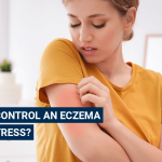 Stress eczema control